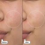 Dr. Jart+ Cicapair Intesive Ενυδατική Κρέμα Προσώπου κατά της Ερυθρότητας με Νιασιναμίδη & Centella Asiatica 50ml - Image 6
