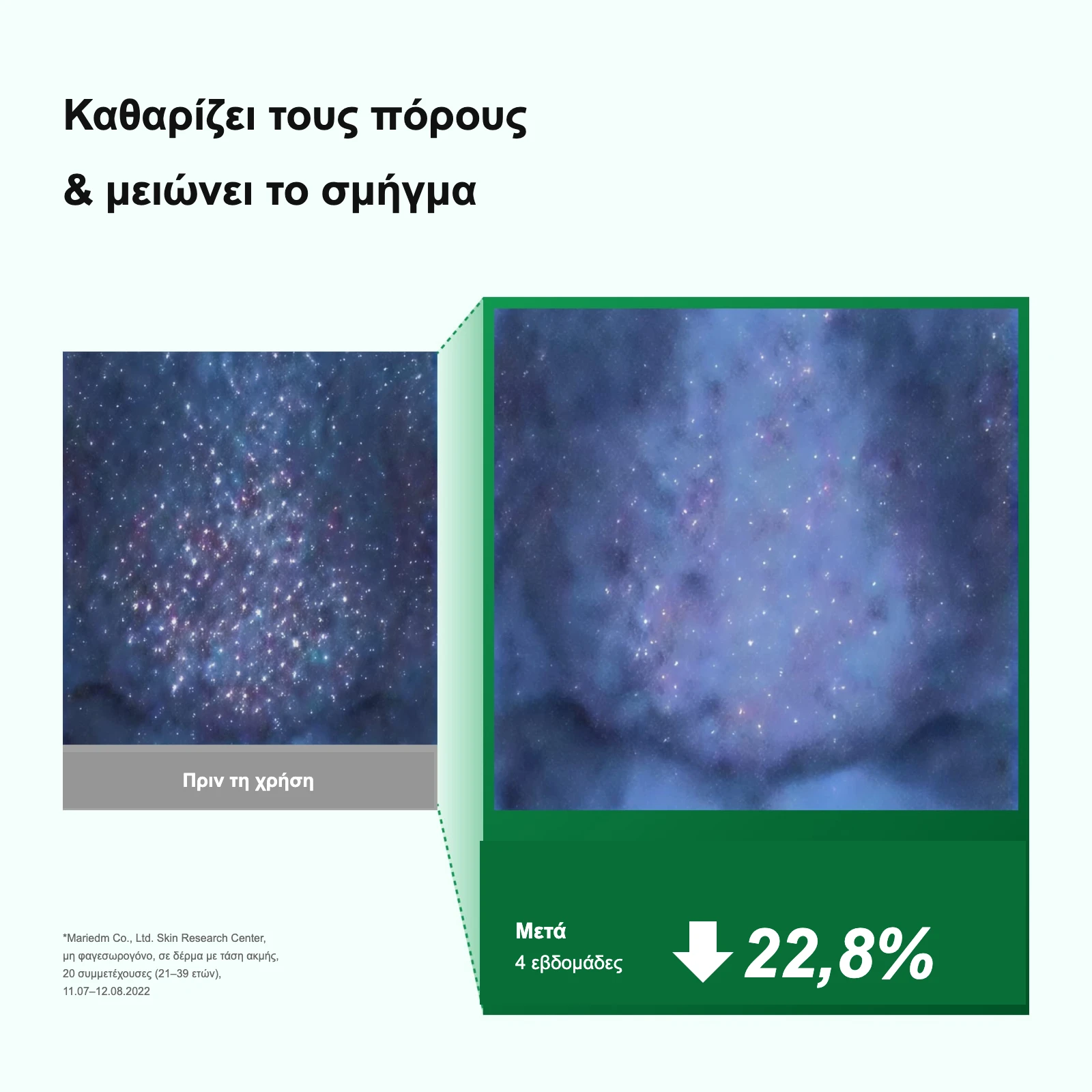 Καθαρίζει τους πόρους και μειώνει το σμήγμα – πριν και μετά