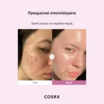 COSRX The Niacinamide 15 Serum – πραγματικά αποτελέσματα πριν και μετά